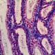 HDMI Digital Microscope Camera